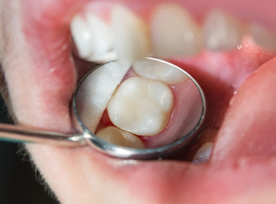 The Most Requested Upgrades At Modern Cosmetic Dental Clinics